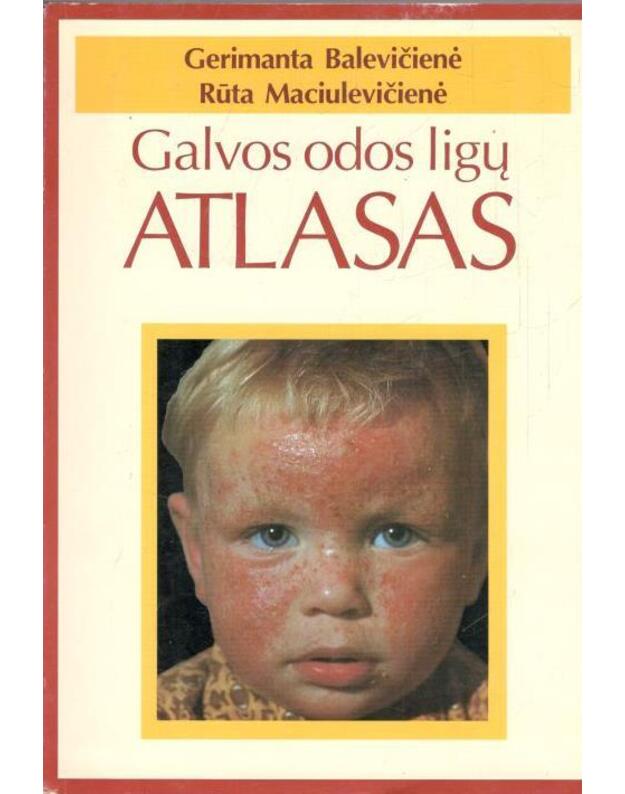 Galvos odos ligų atlasas - Balevičienė Gerimanta, Maciulevičienė Rūta