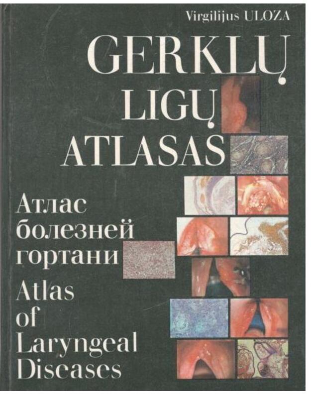 Gerklų ligų atlasas - Uloza Virgilijus